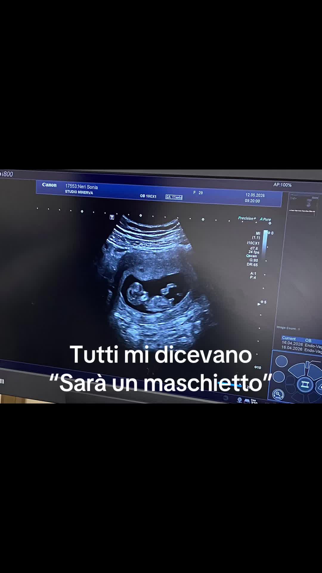@Sonia Neri