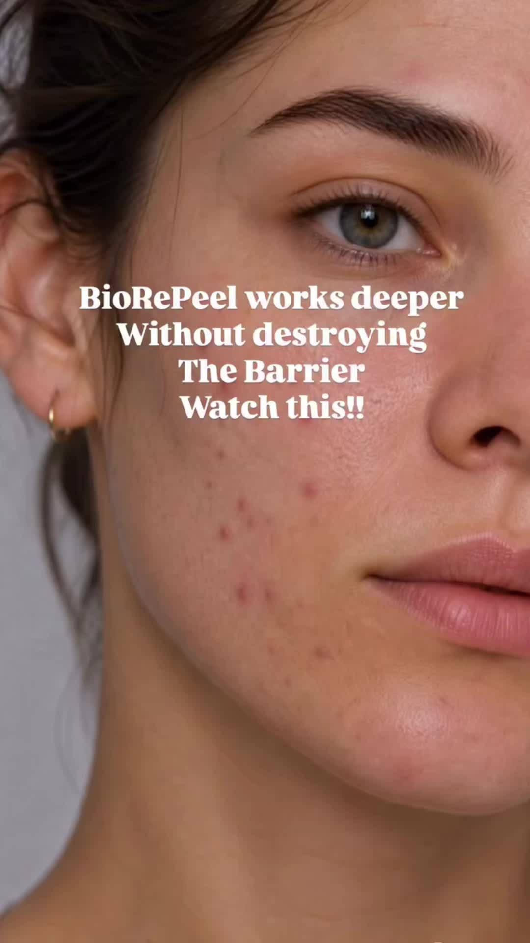 @GlowUp | Laserclinic & Beauty