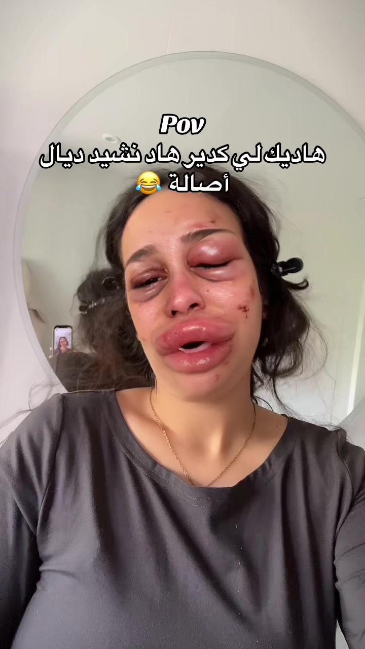 @Naccima moutya 🇲🇦🇫🇷