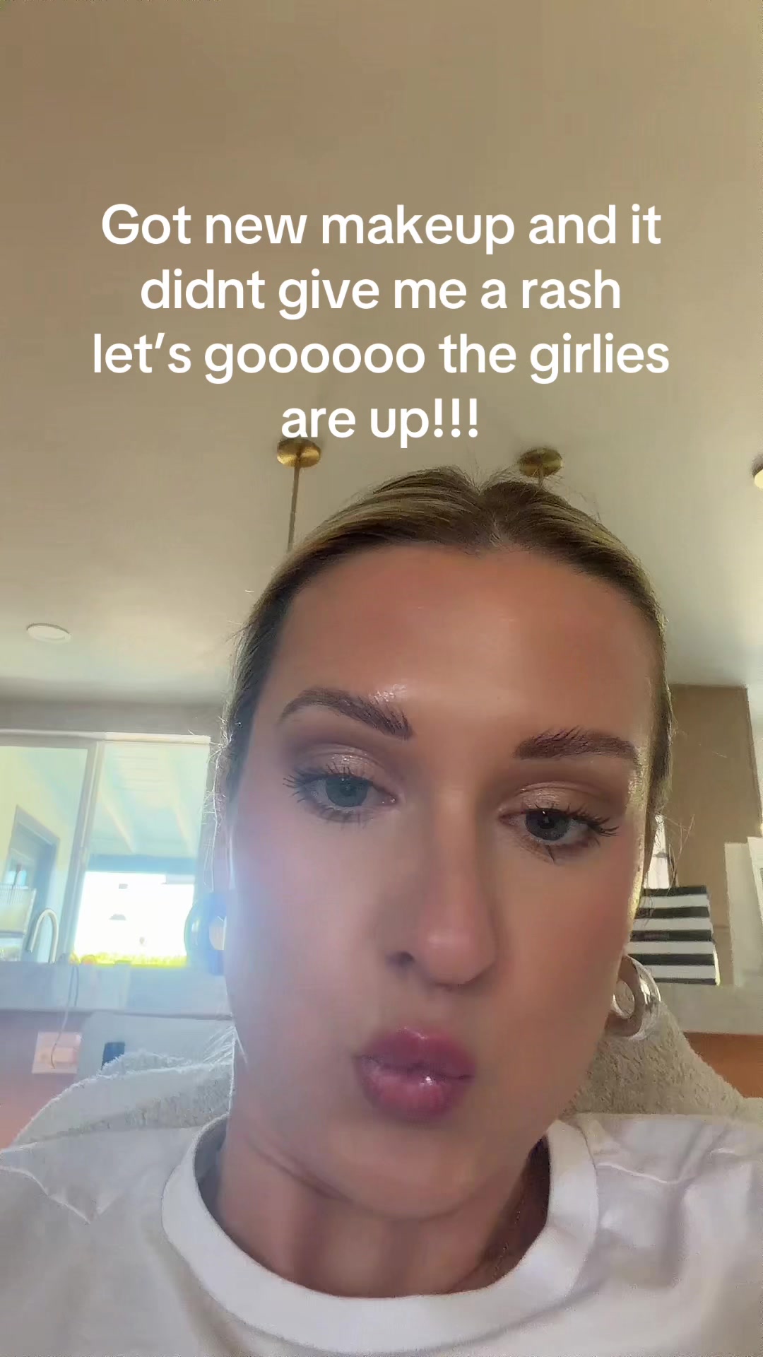 @allergygirl