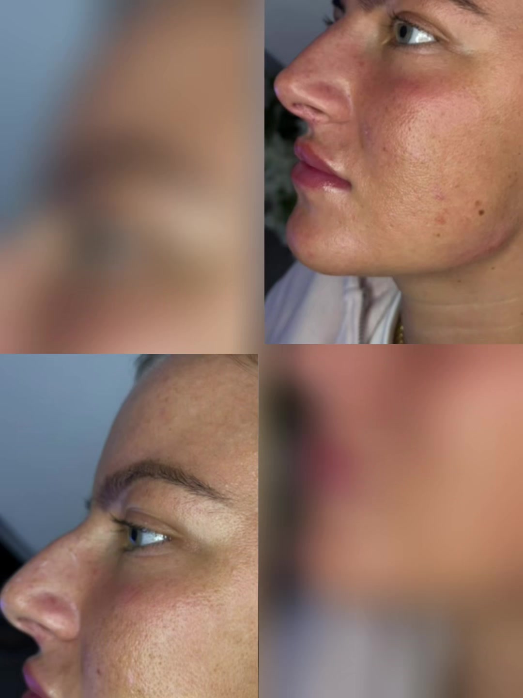@Superfacial Aesthetics