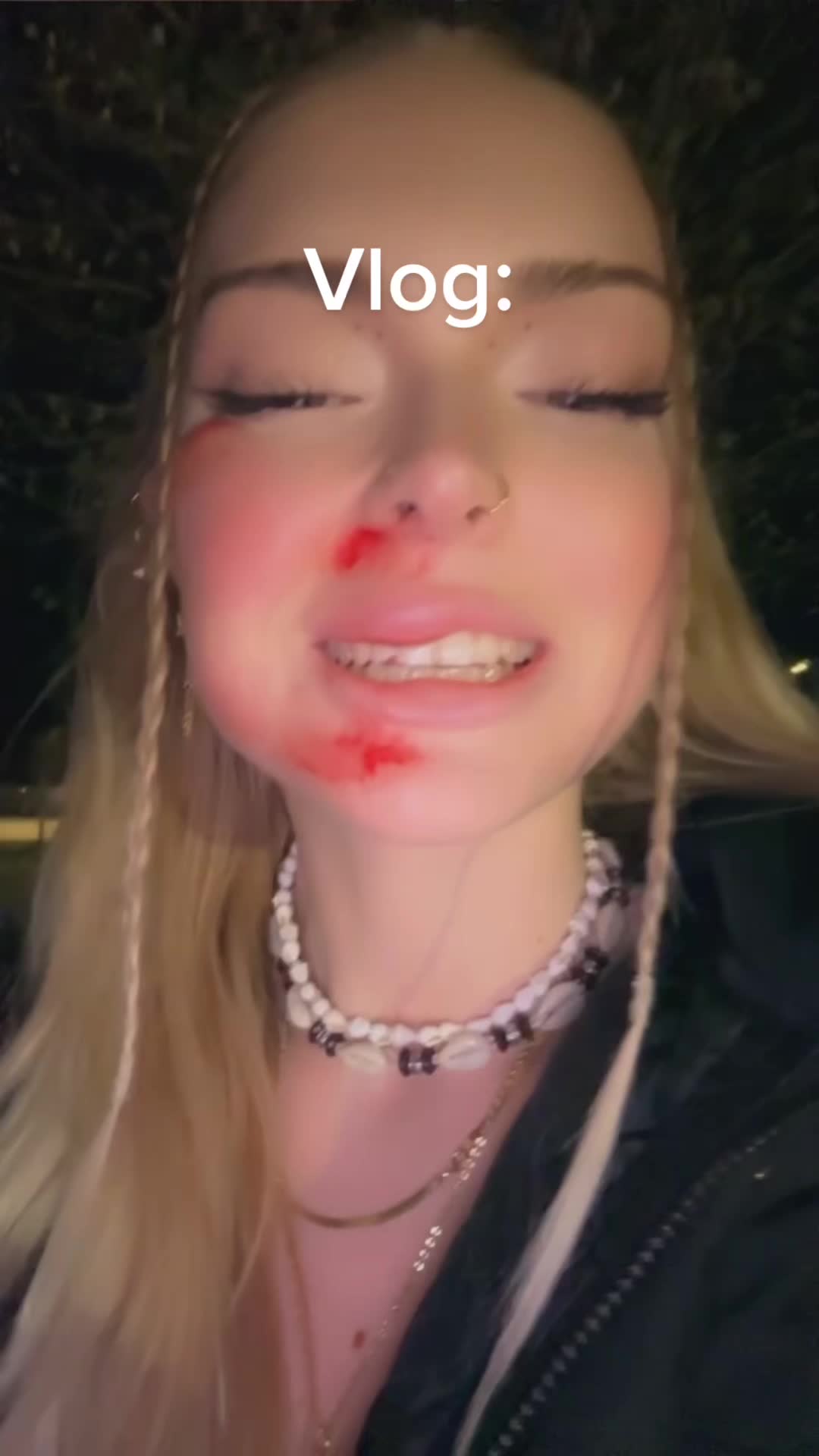 @em