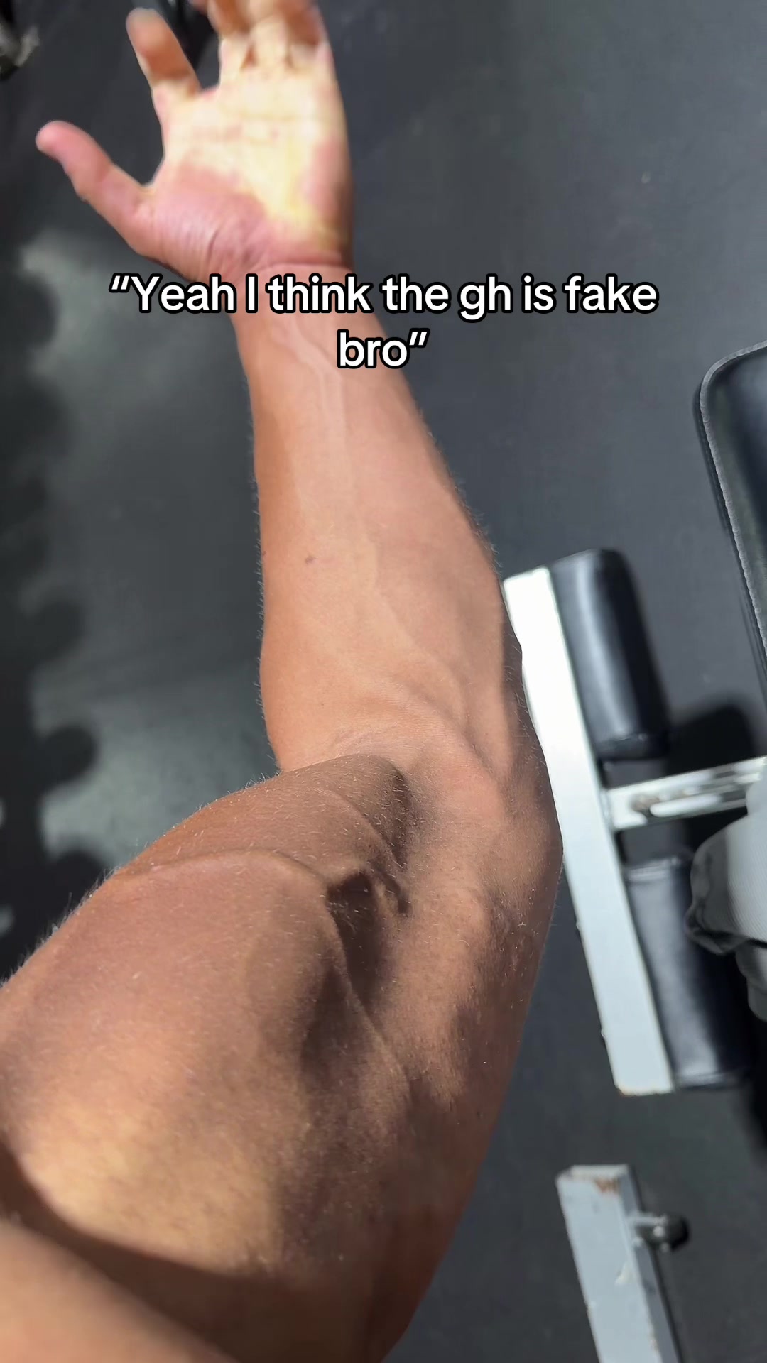 @Jett