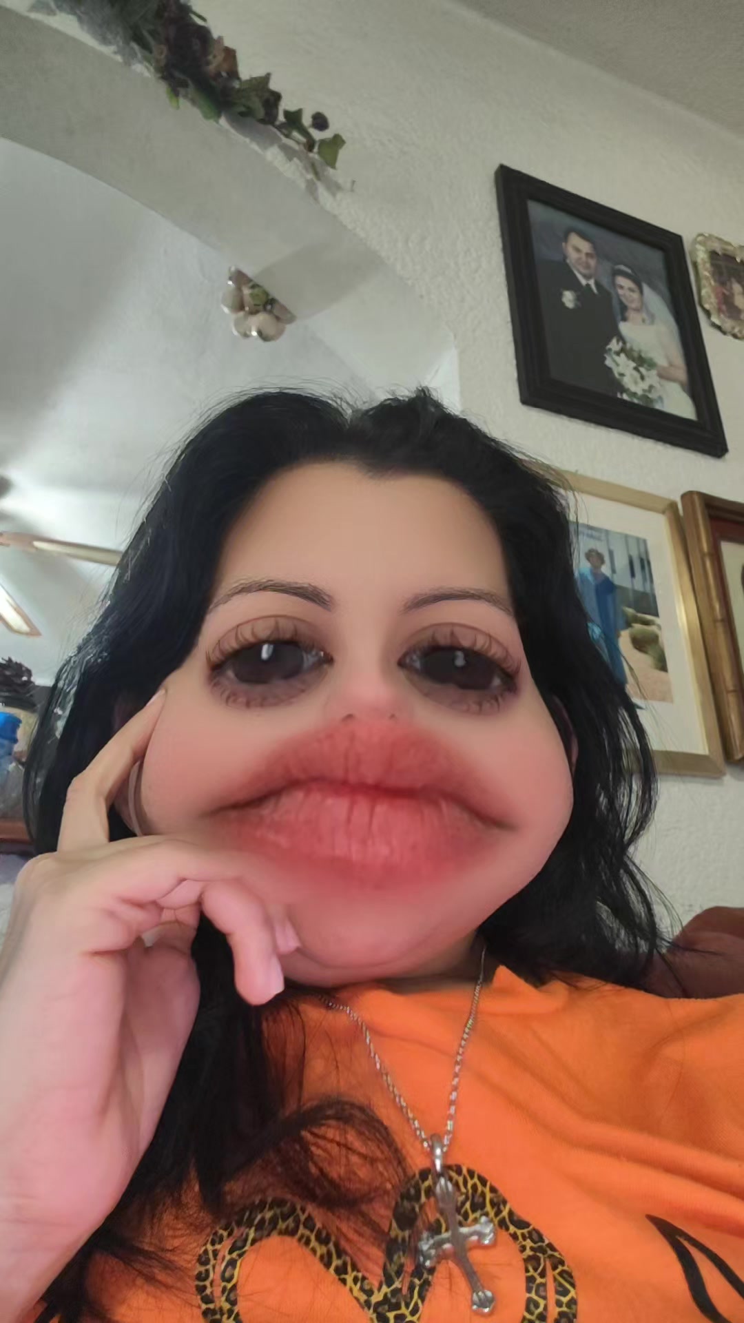 @Lupitta Orozco Bariatric