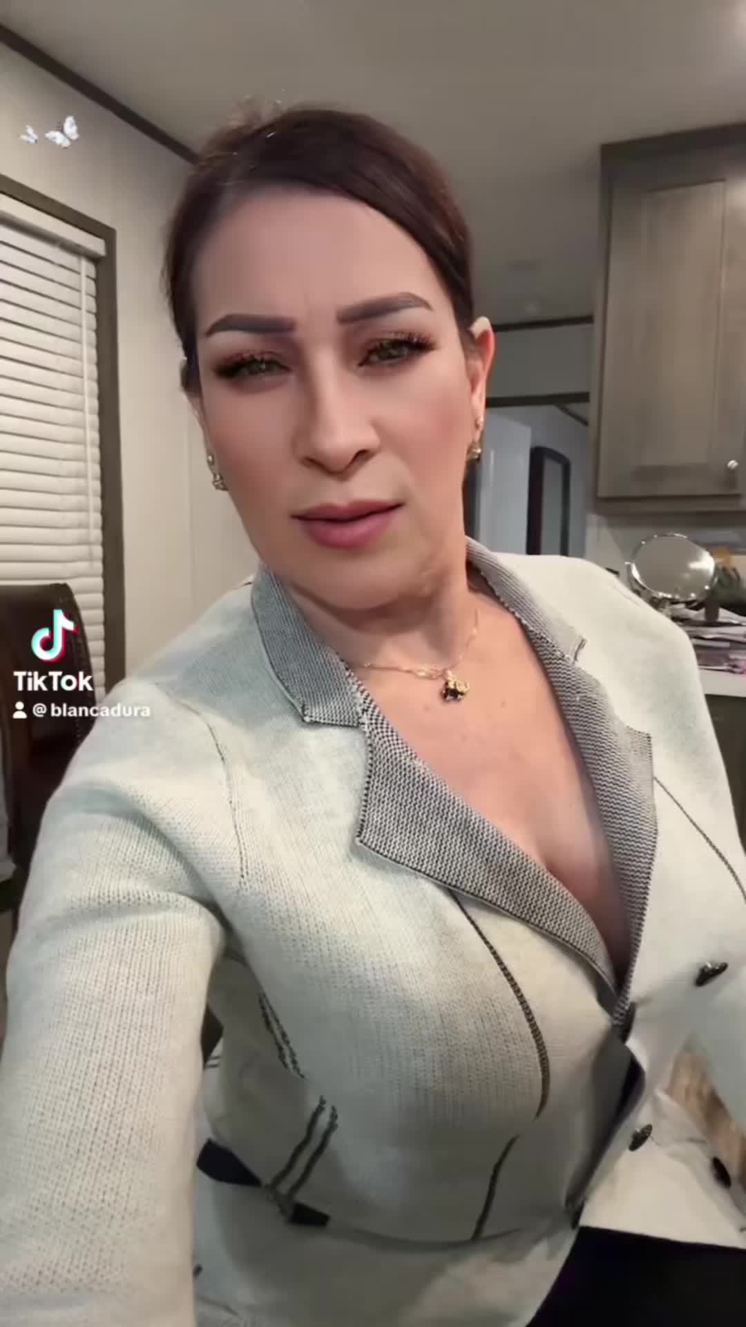 @🎀blankita💝de Chihuahua 🎀
