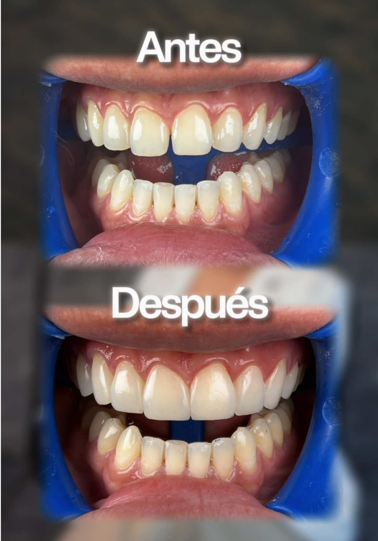 @Smiledent