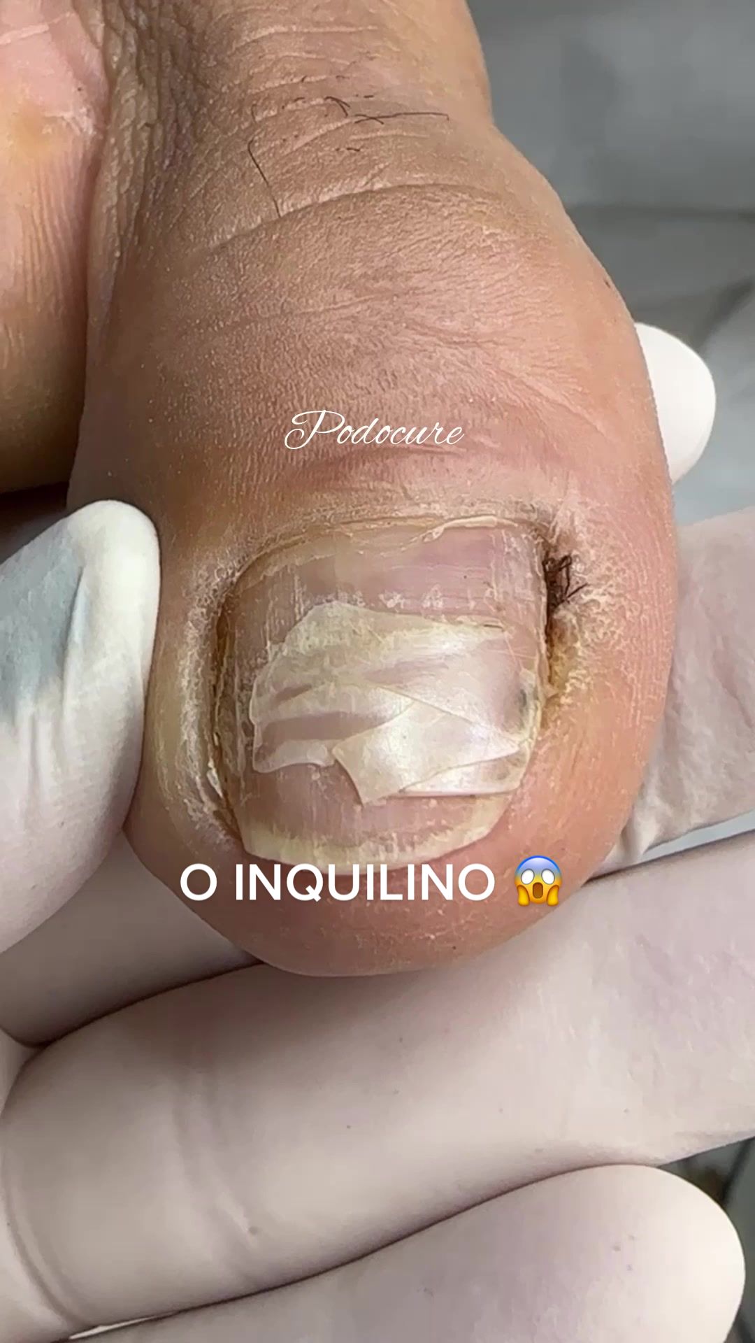 @Podocurebr