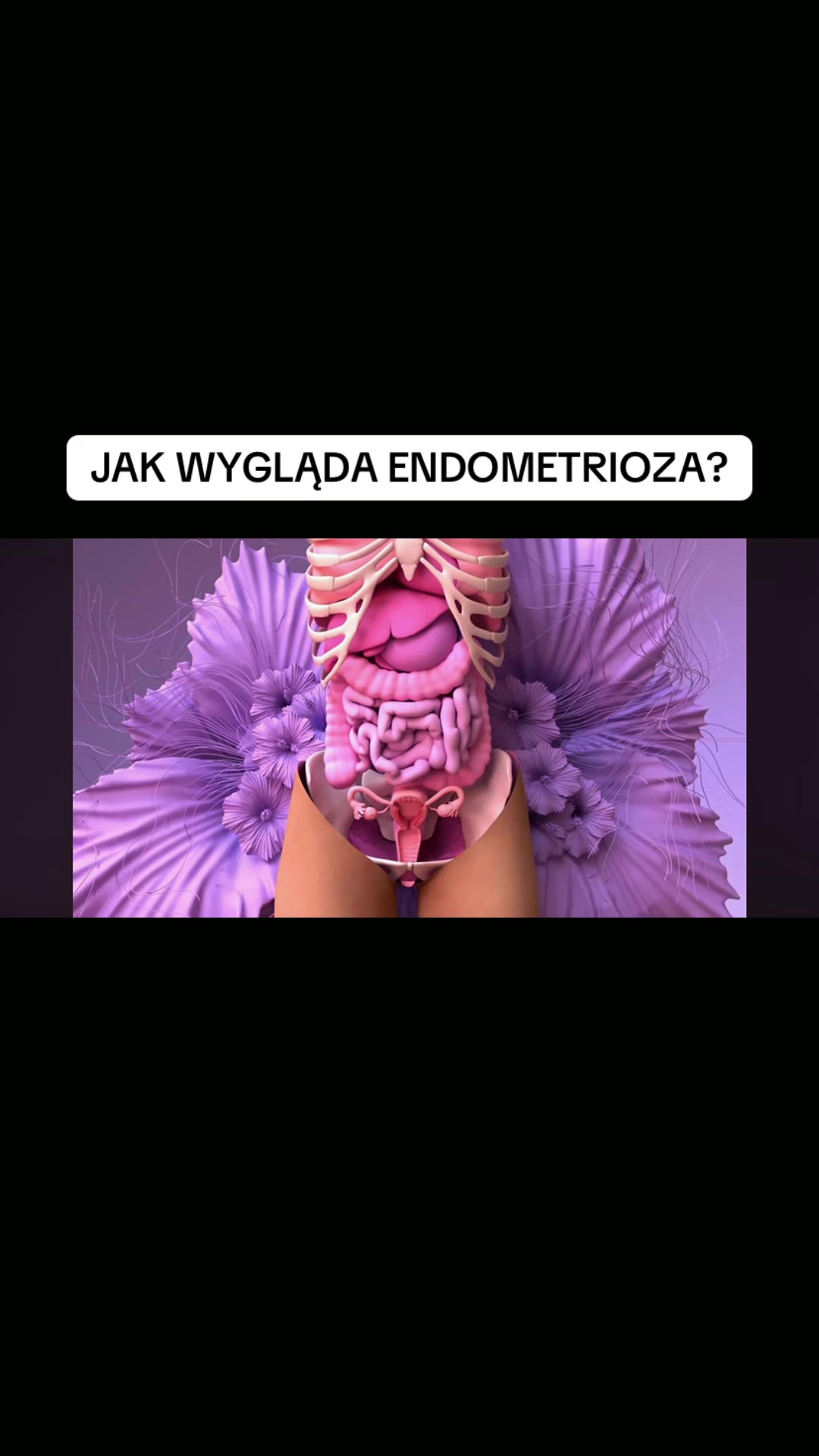 @EndoMona🎗️