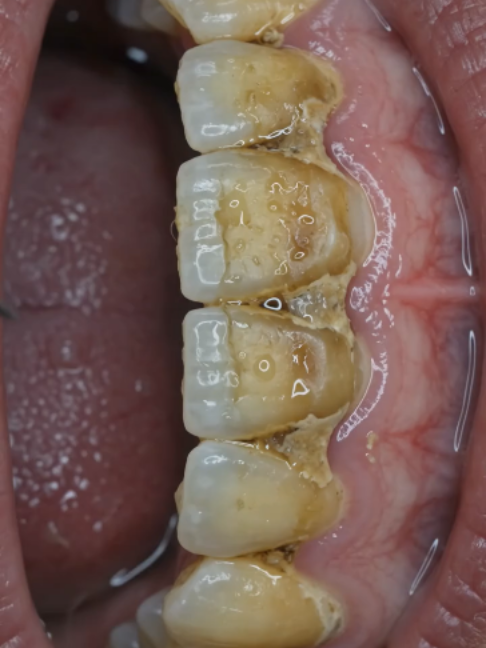 @DentalTreatment