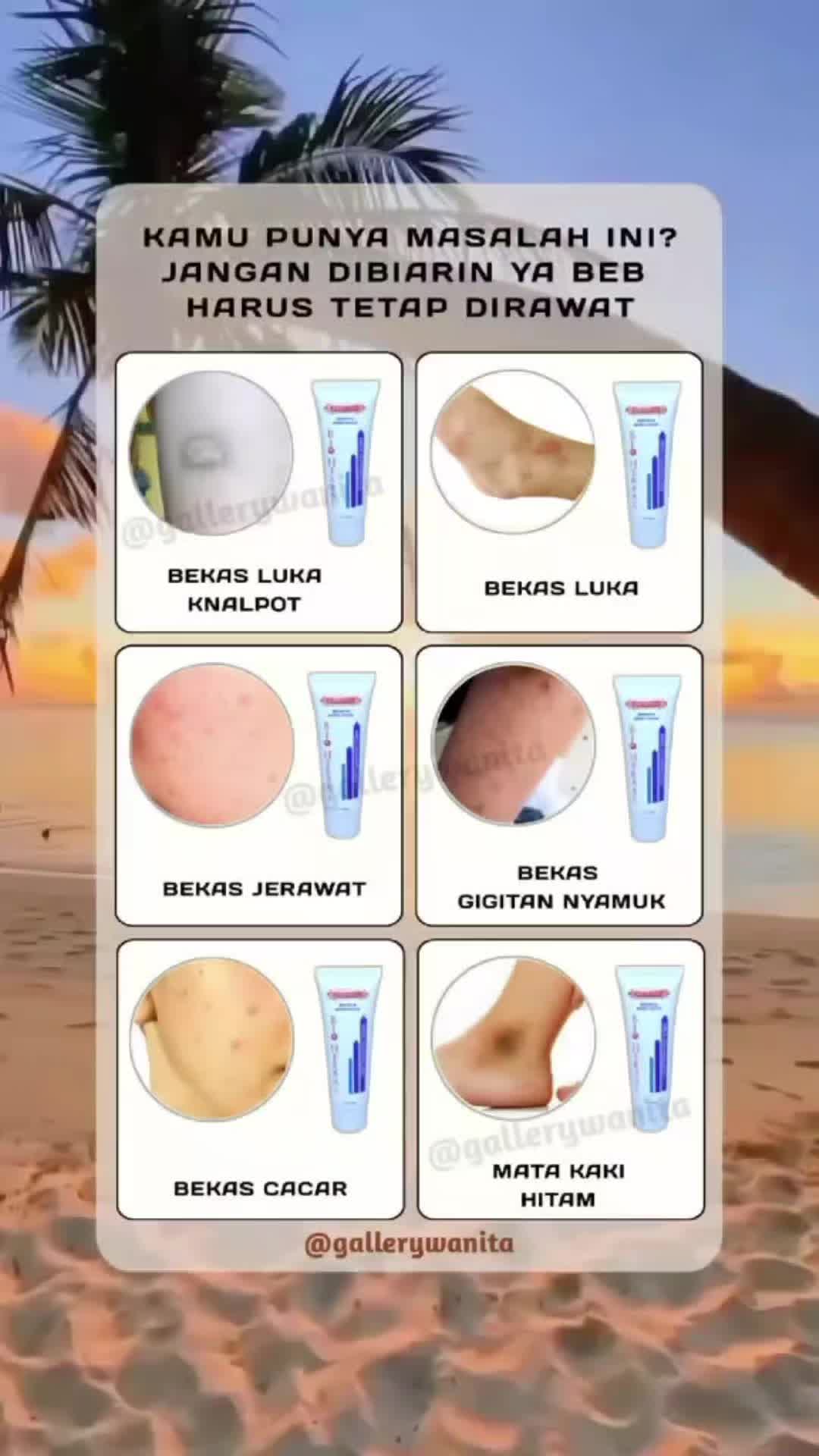 @Cirancana