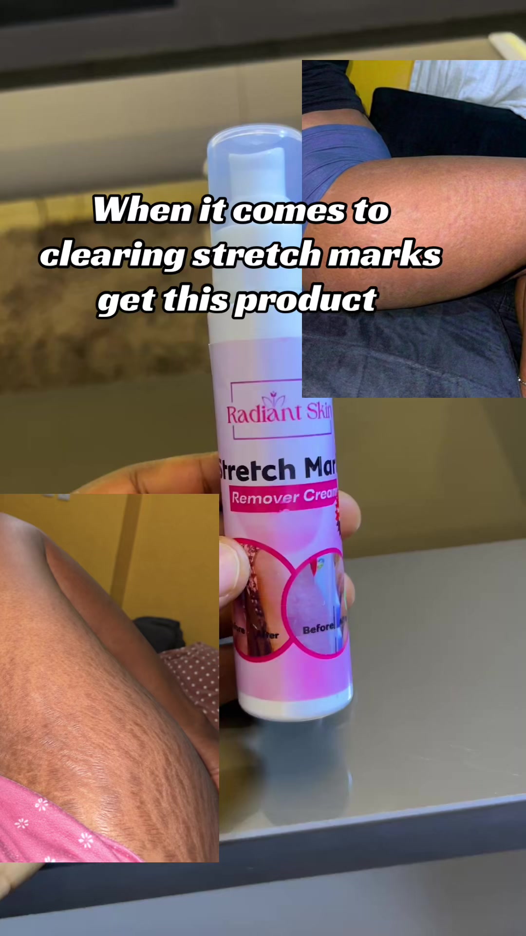@Radiant skin
