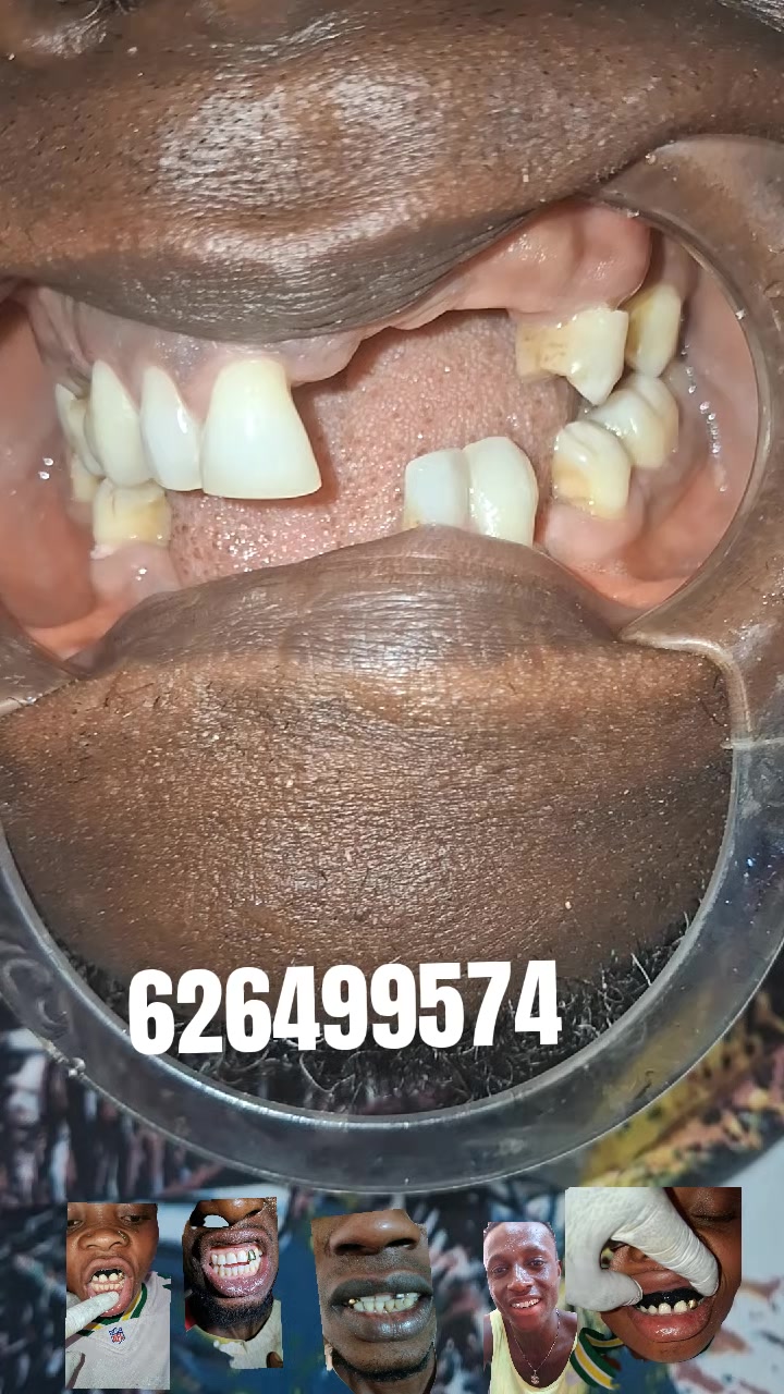 @Djoballa le dentiste