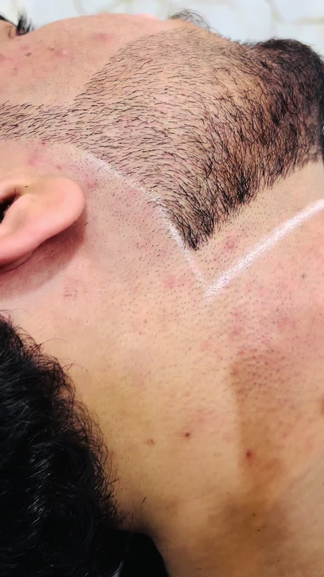 @Laser Grafix clinic