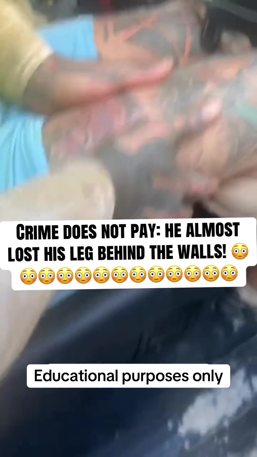 @officialberner420 🩸💔