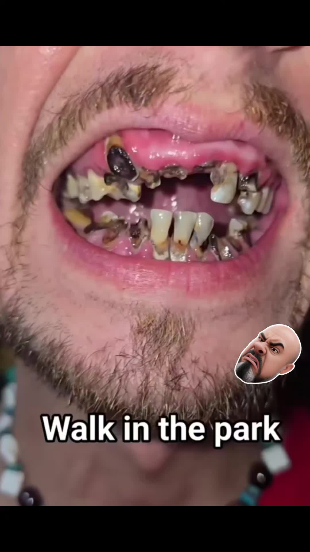 @SAVAGE VIDS