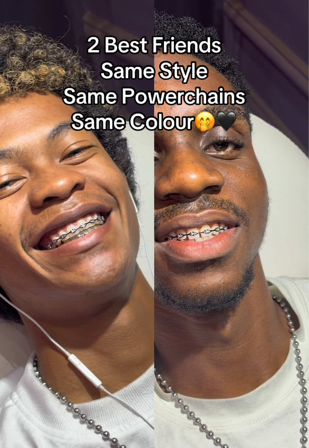 @Abuja Fashion Braces/Toothgems