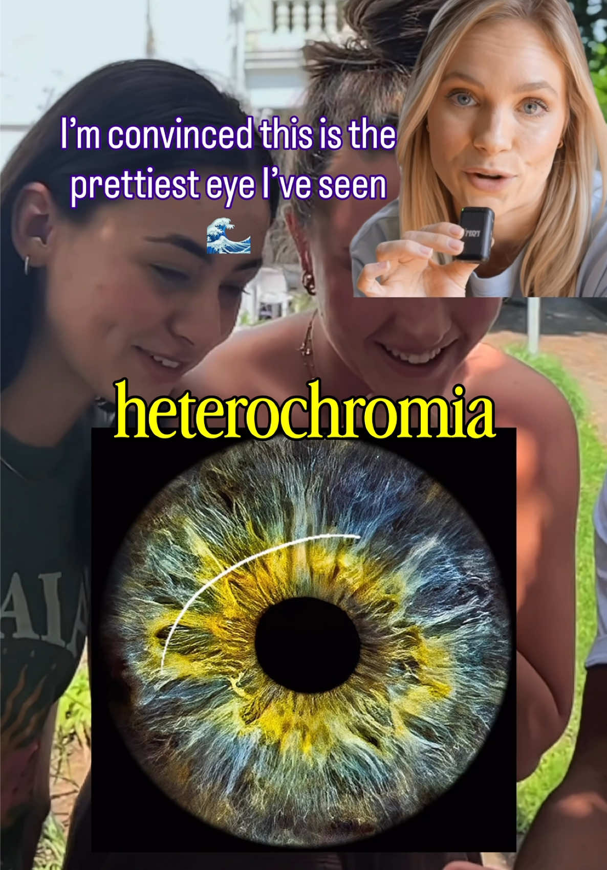 @Eyepic