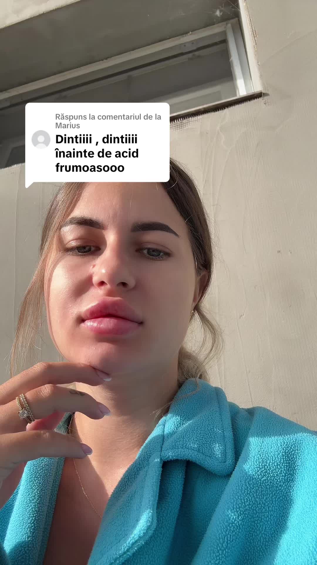 @💎Alice Elena💎