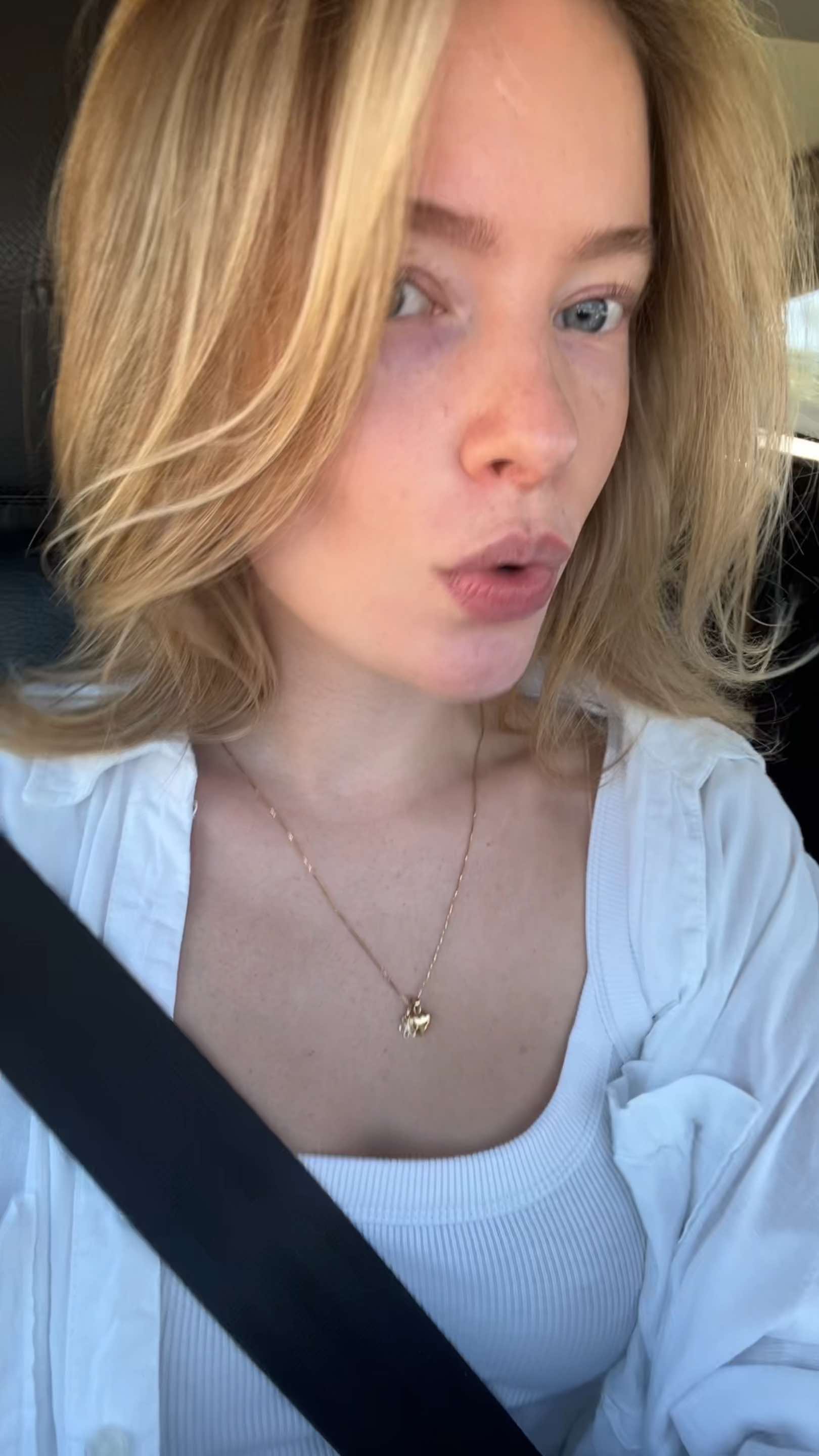 @W