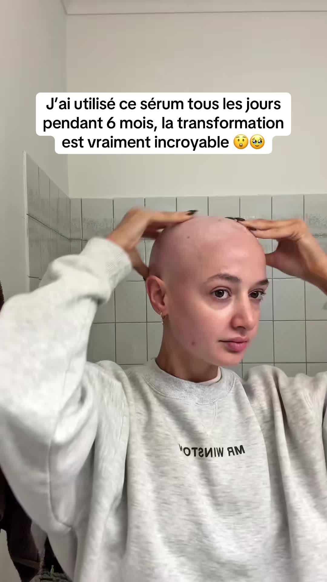 @Lux’Hair Growth FR