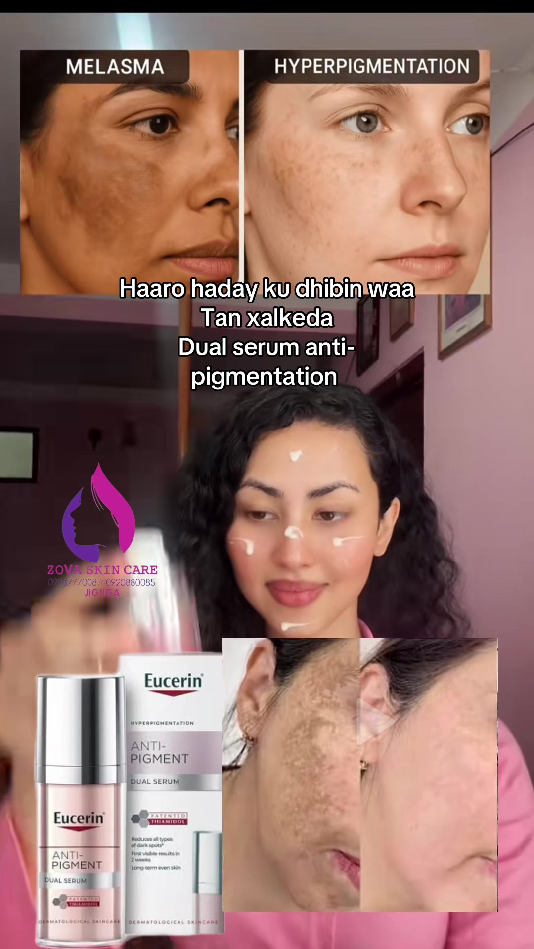 @ŽOVA ŜKIN Č̣ARE