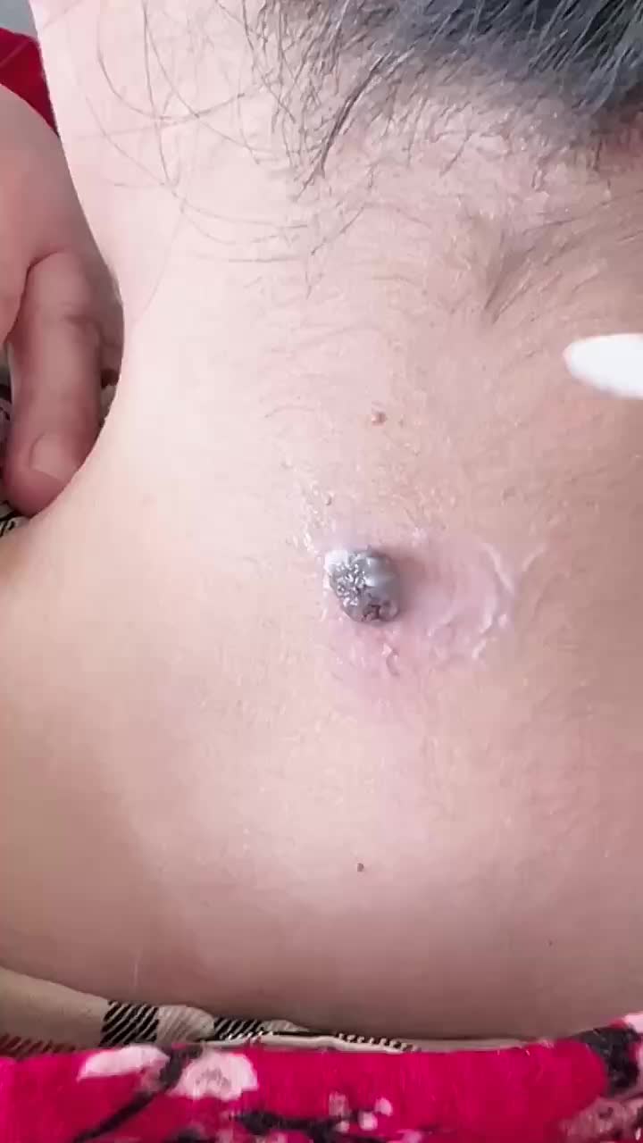 @Skincare Queen👑