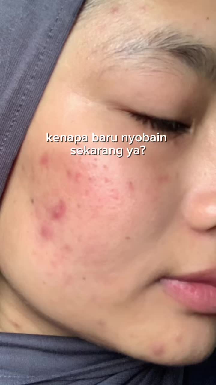 @rastia