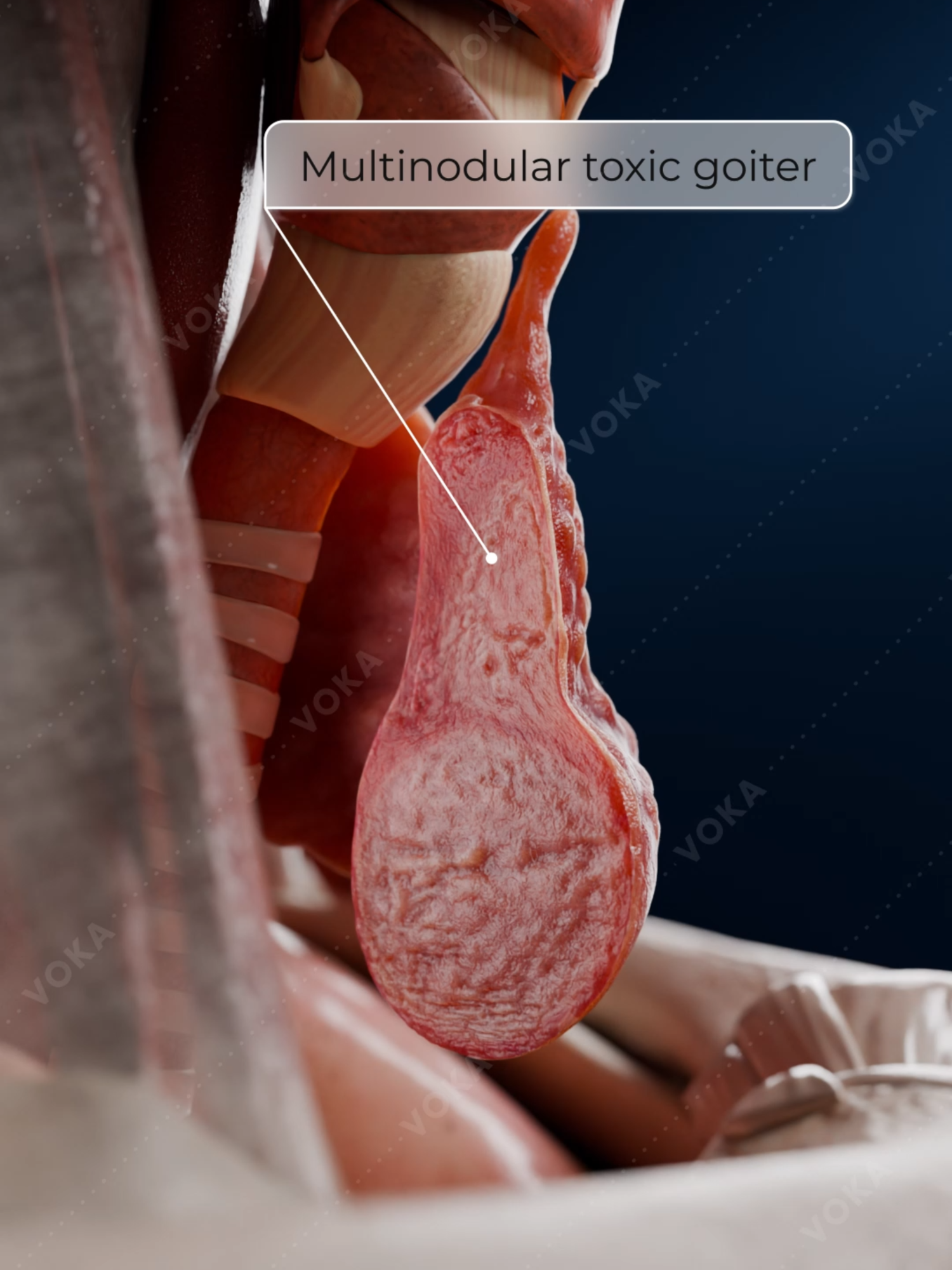 @VOKA 3D Anatomy & Pathology