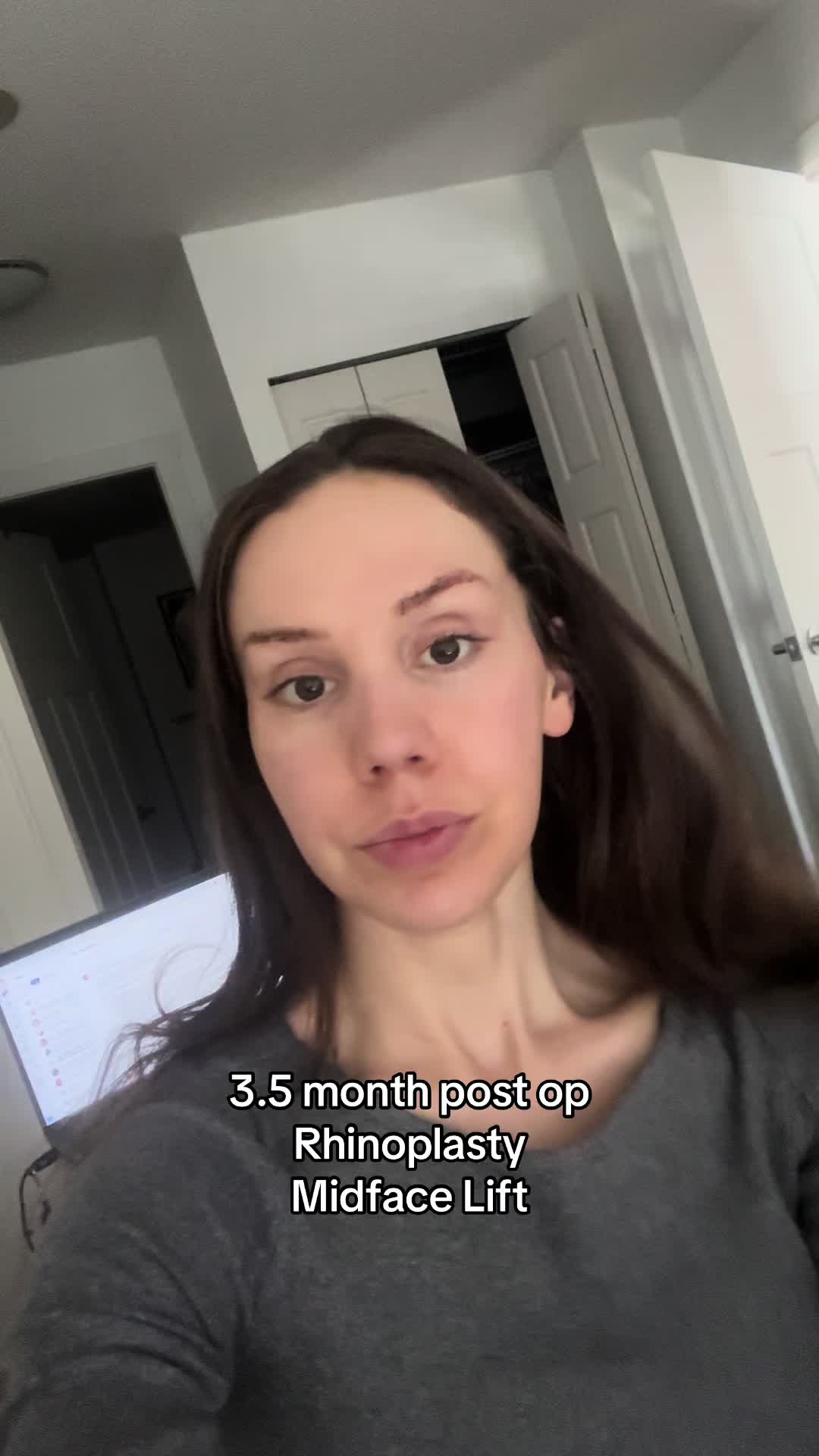@glowalignment