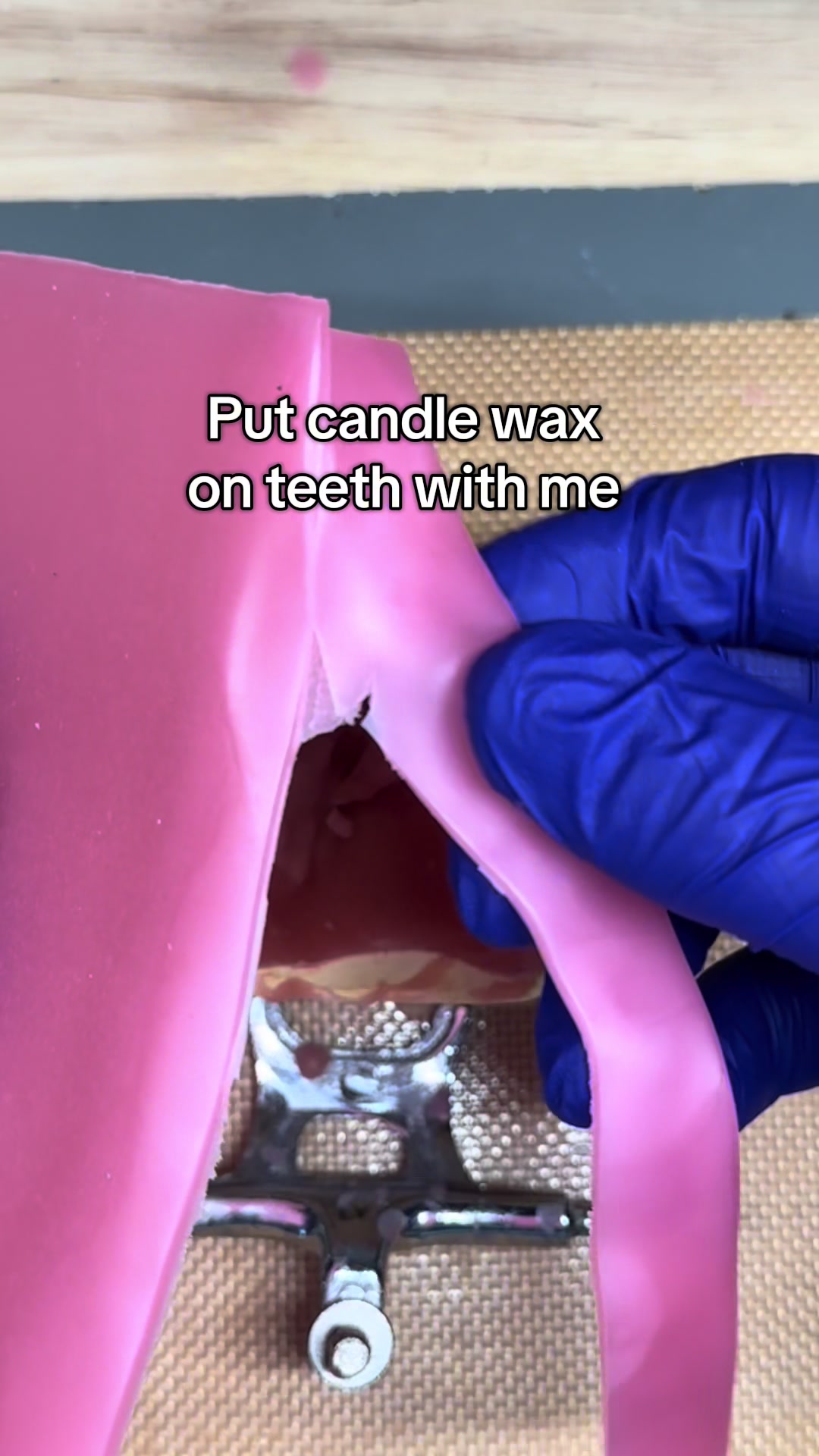 @Dental tech 🦷