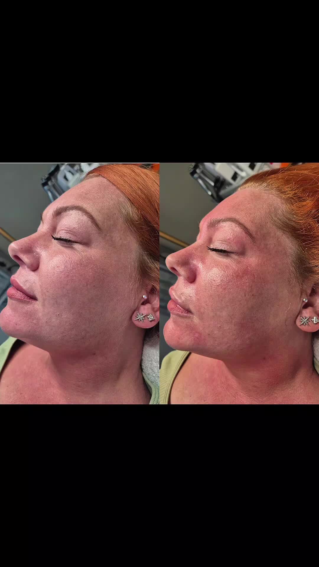 @Vibe Aesthetics