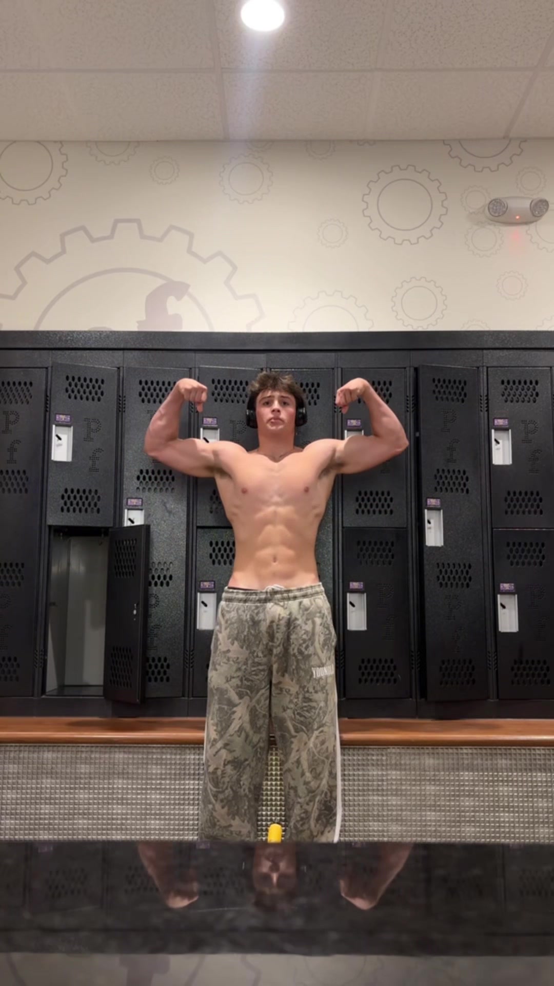 @anthonygach0
