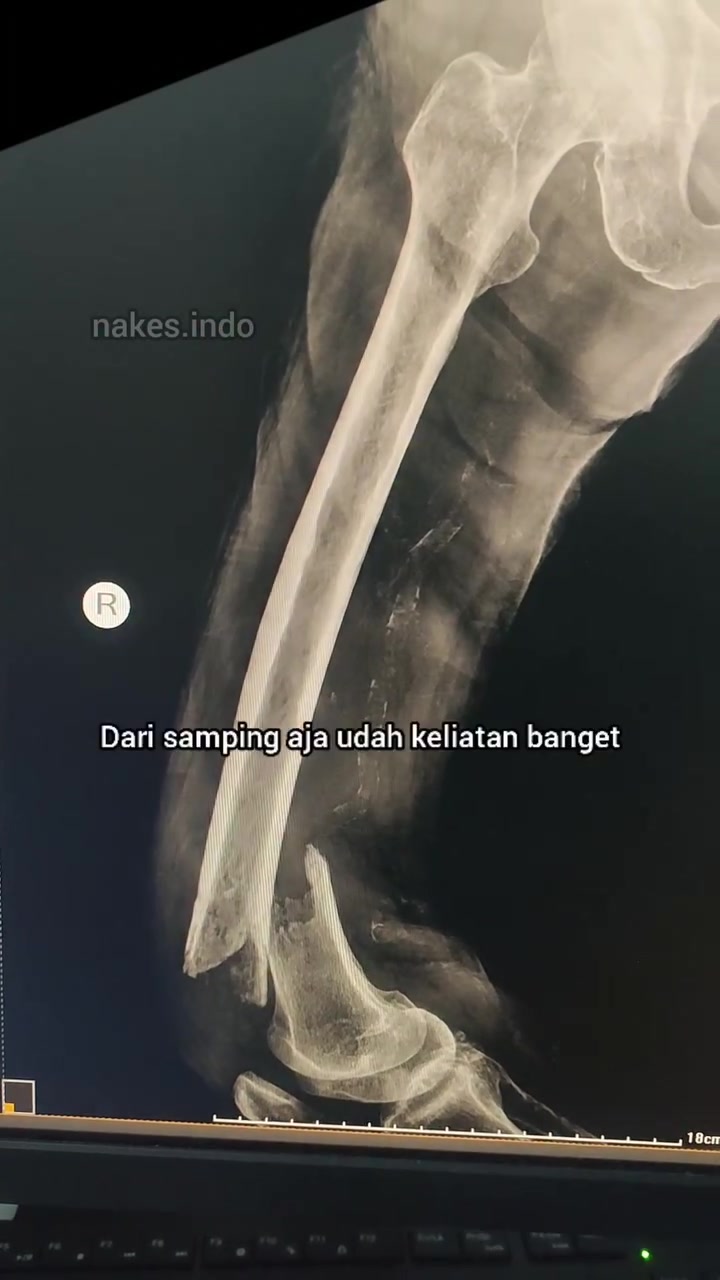 @Sobat Radiology
