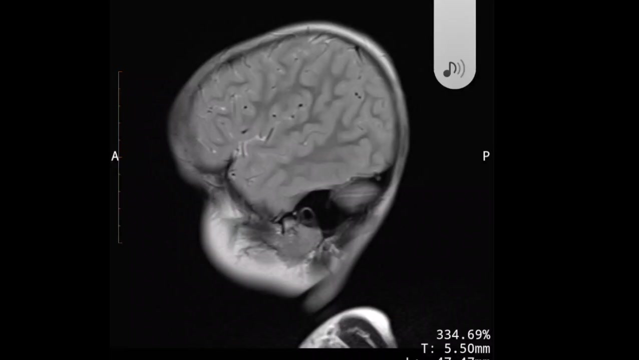 @Dr Arshad Child Neurologist