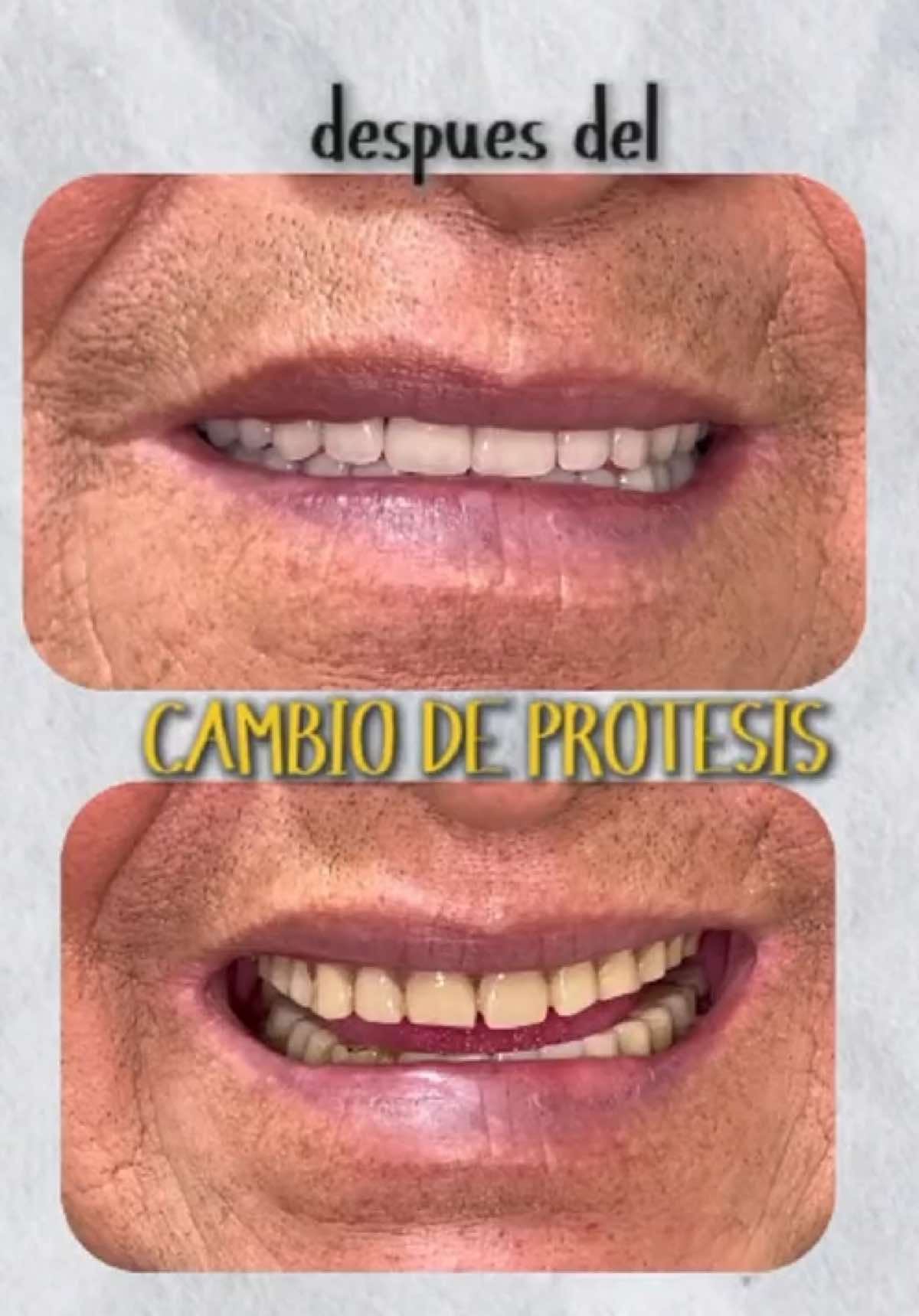 @pro.dental.od