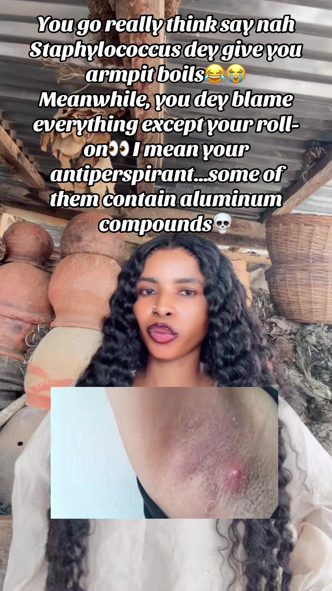 @GeNz_alagbo🐍🍯