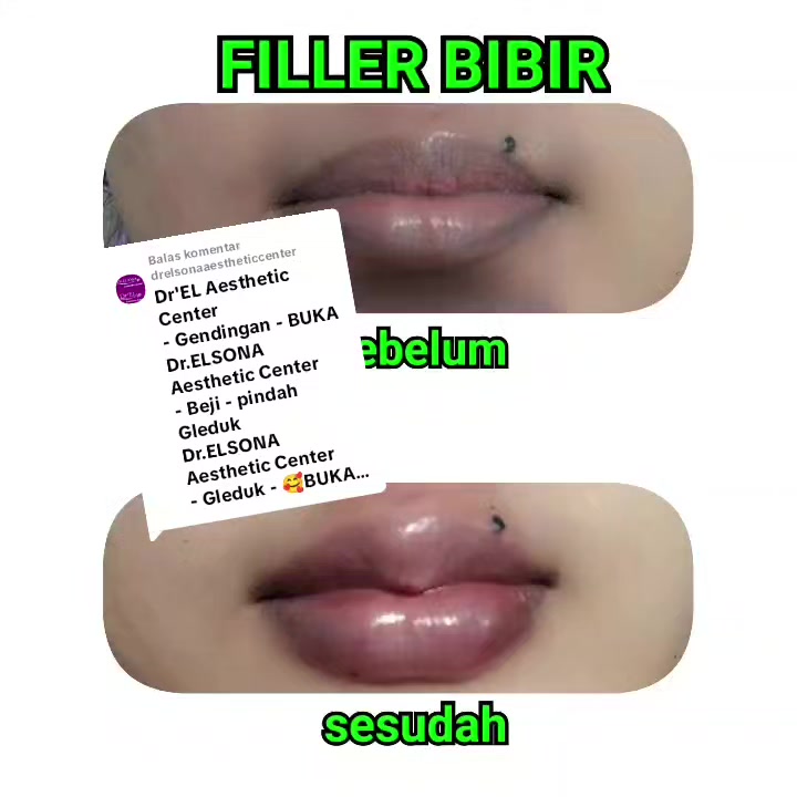 @DrELsonaAestheticCenter
