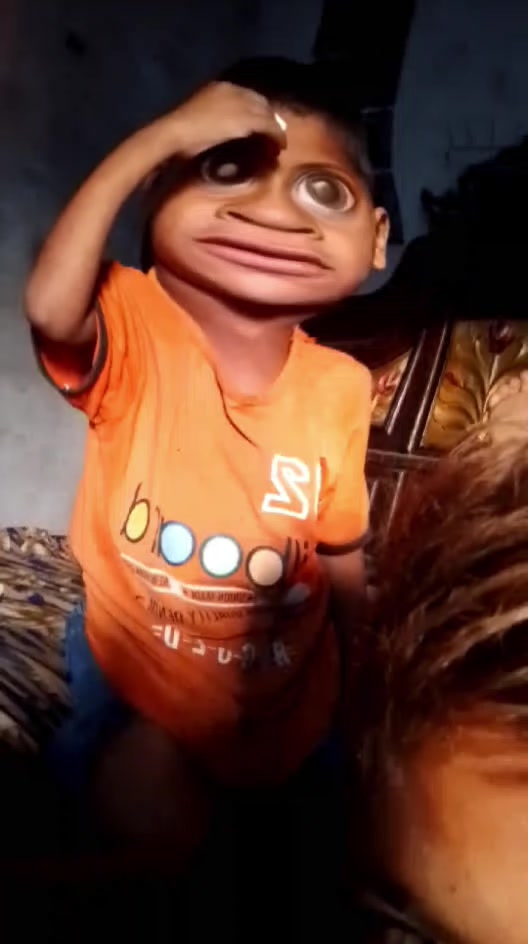 @Golu