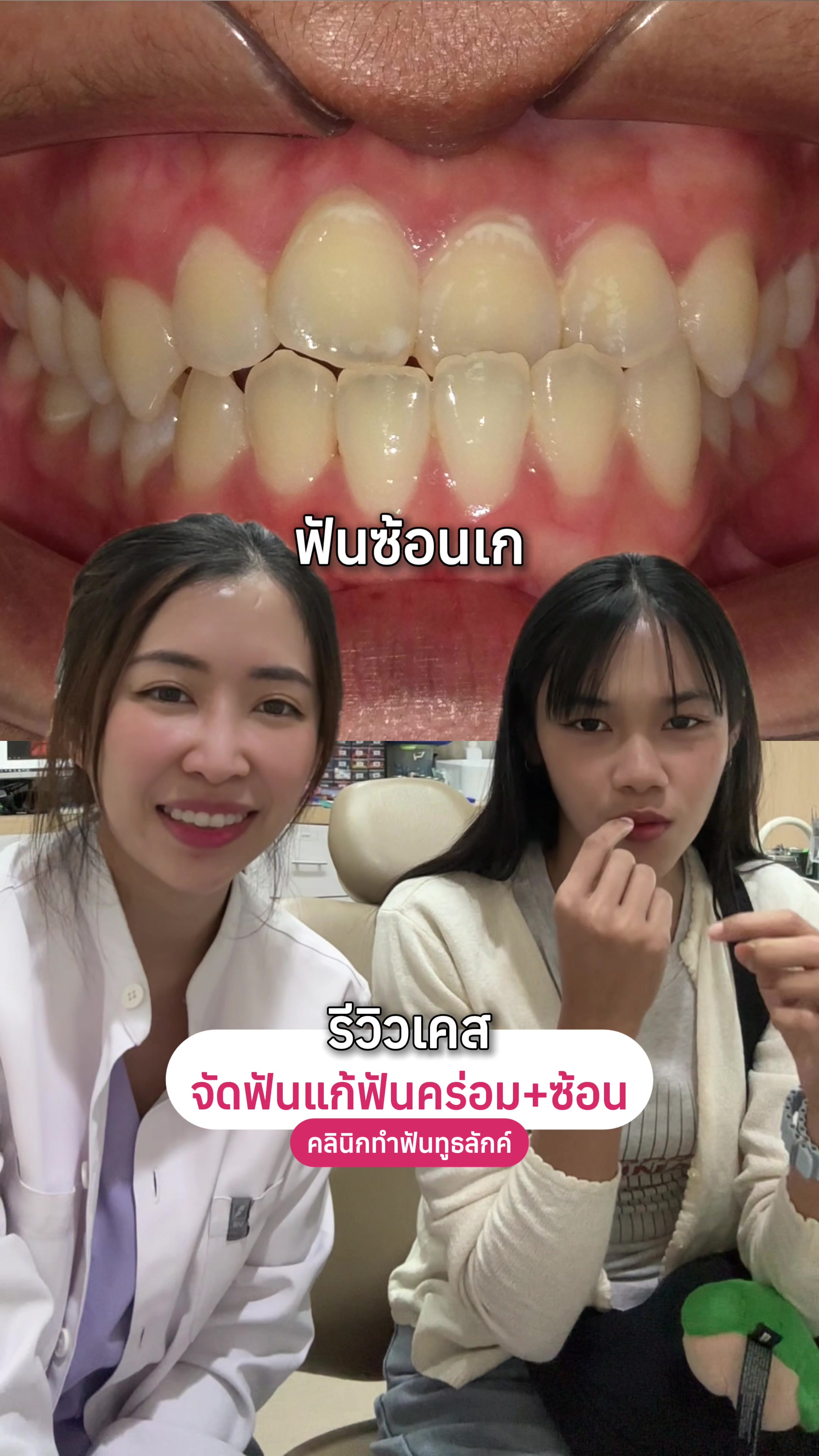 @ณัฐคุณ (Nuttakul Dent) 🦷