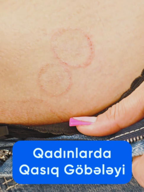 @Dr.Eldar Məmmədov