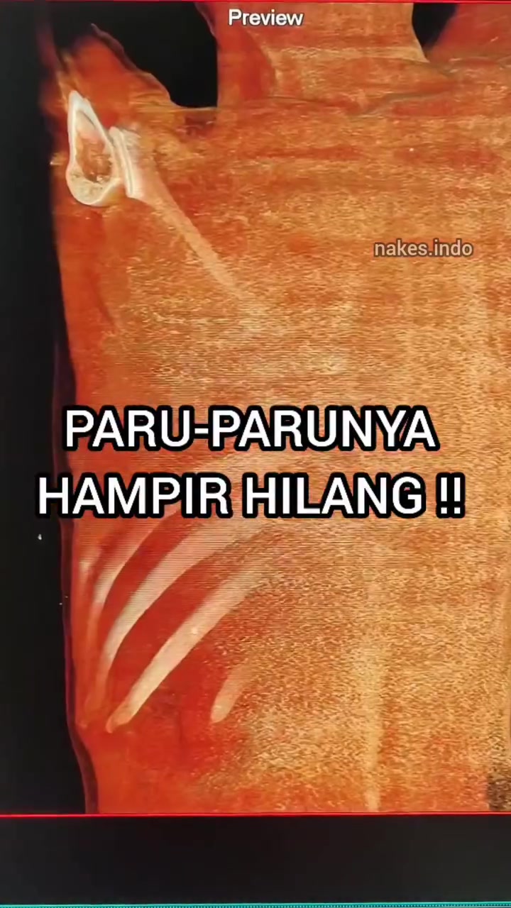 @Sobat Radiology