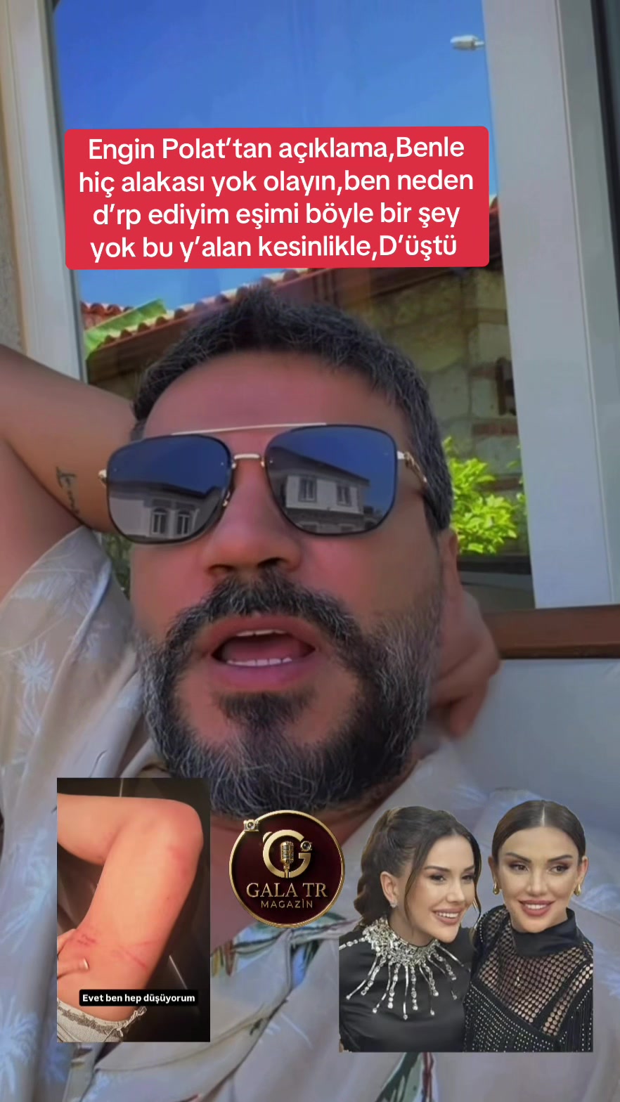 @GALA TR_MAGAZİN