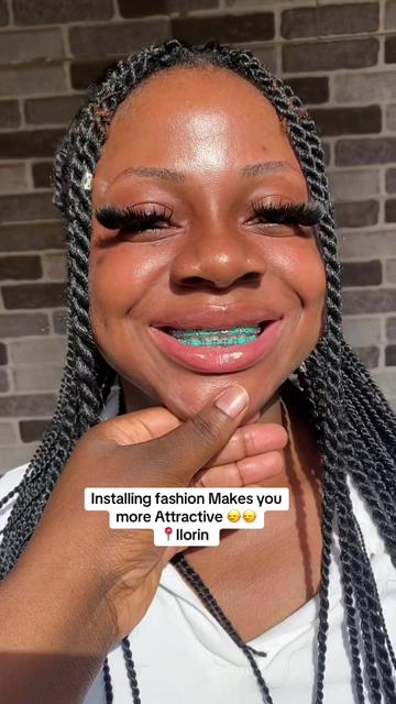 @Braces.bymavi|Smile Aesthetics