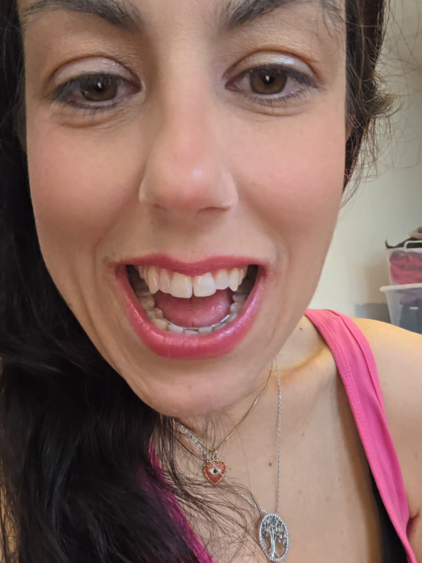 @Giom80