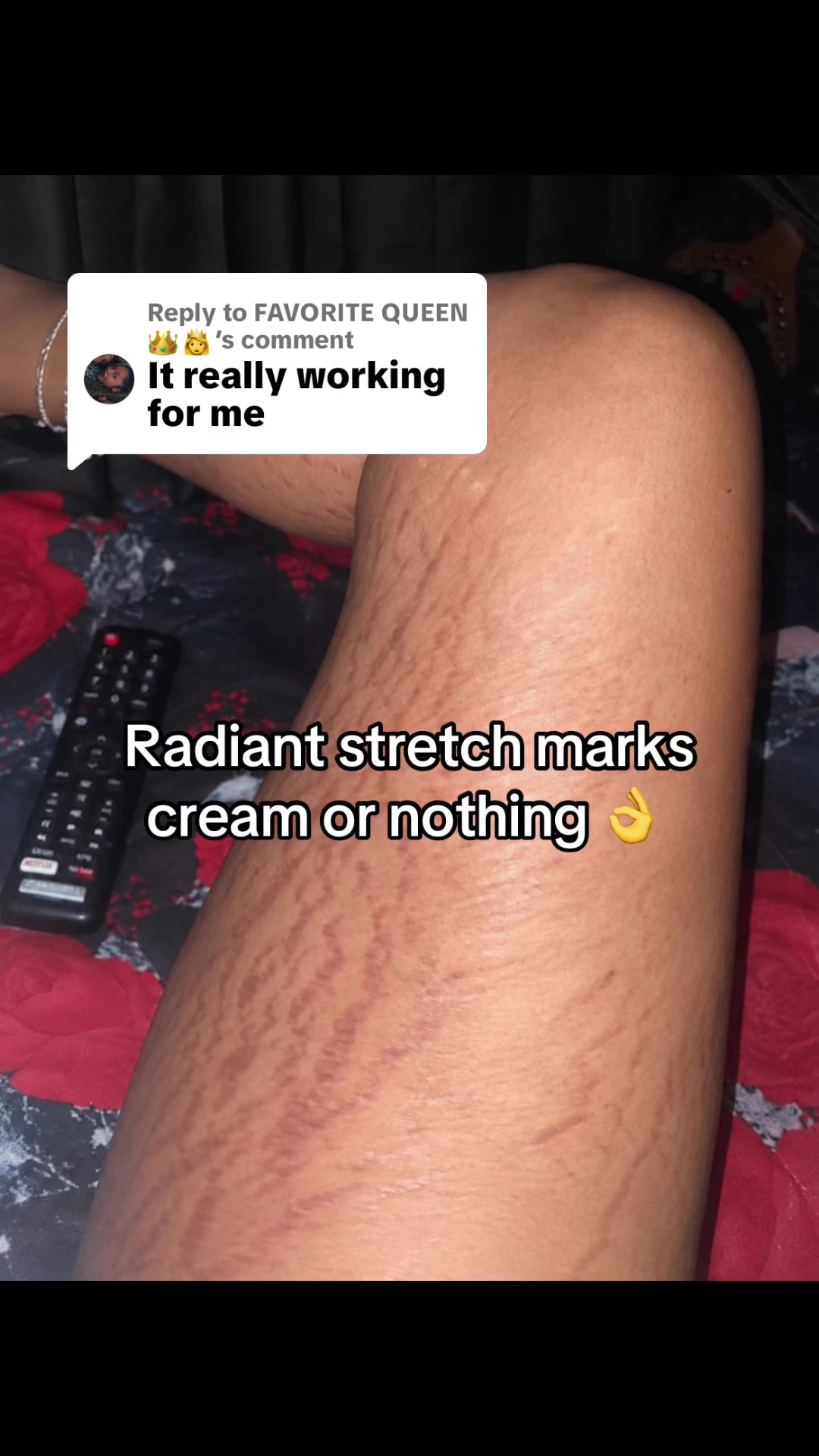 @Radiant skin