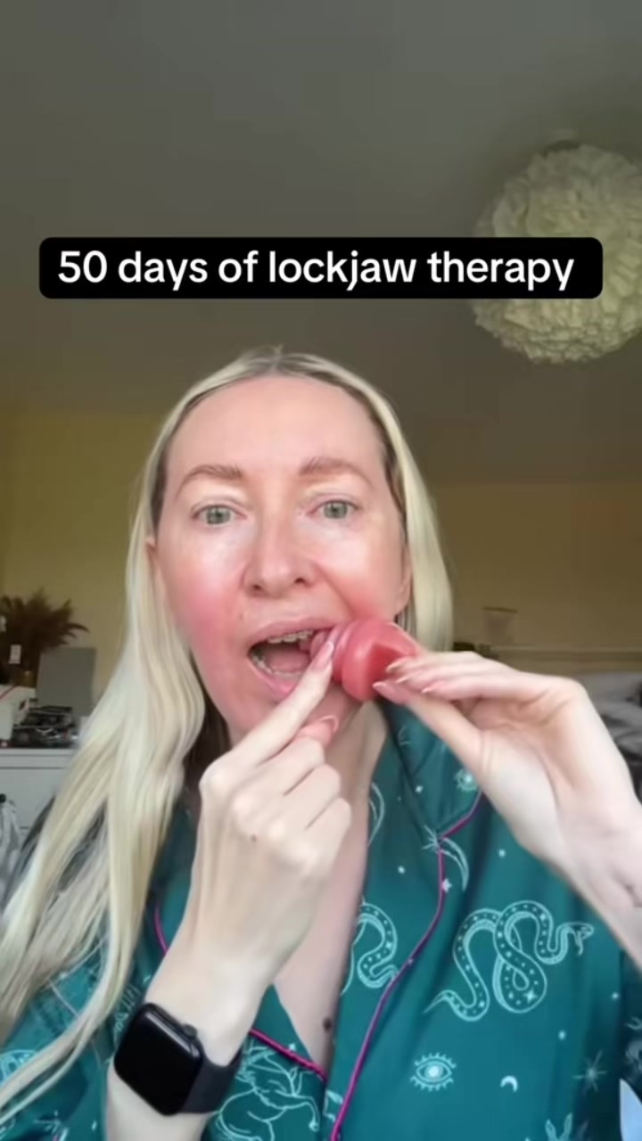 @Mylockjawlife