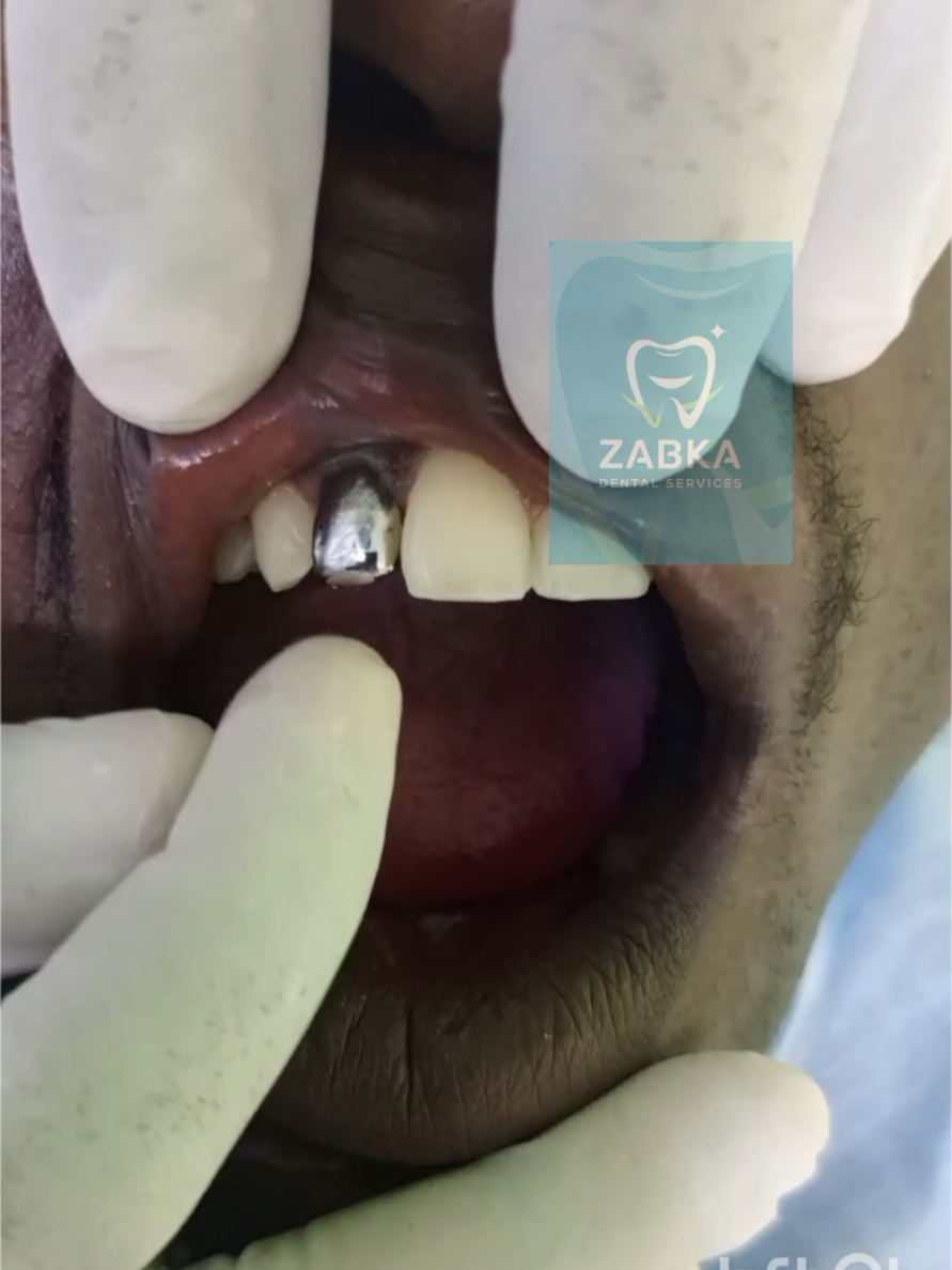 @Zabka Dental