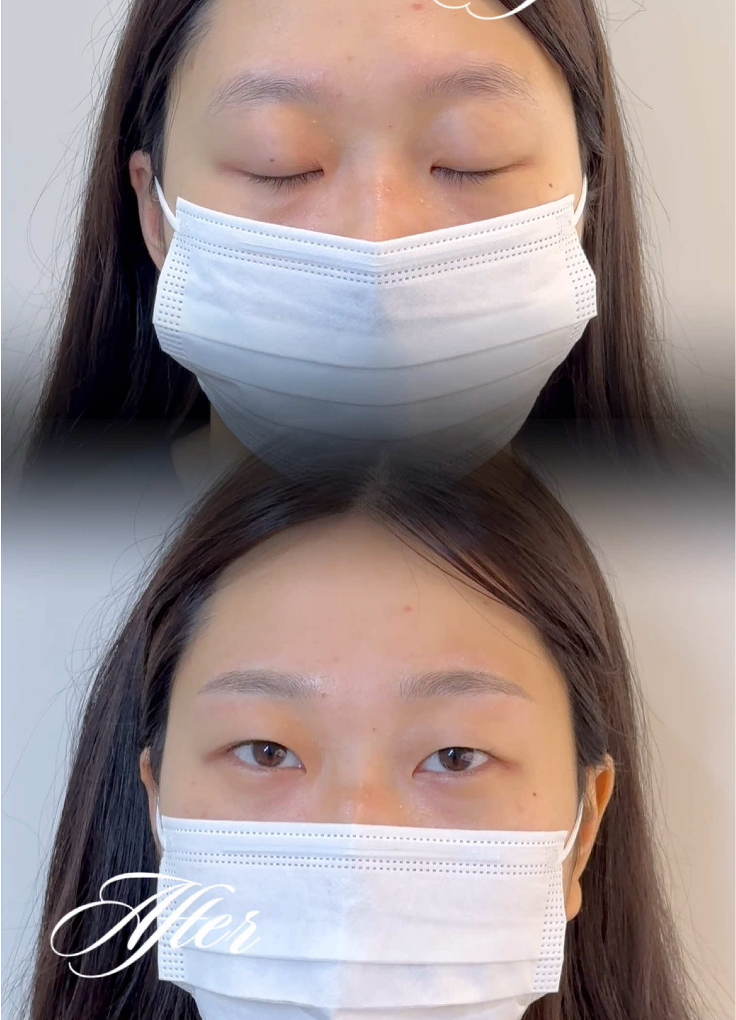@써지브로우 surgebrow