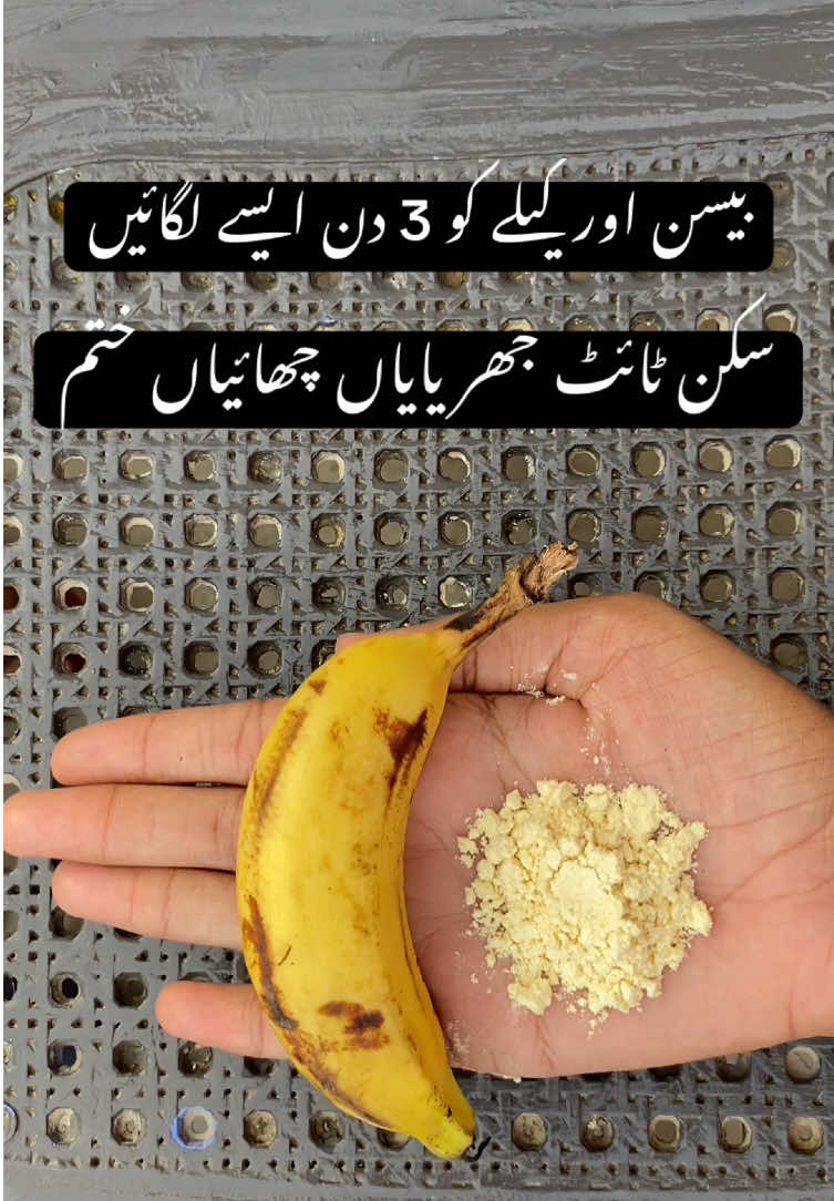 @RemdyGuru35