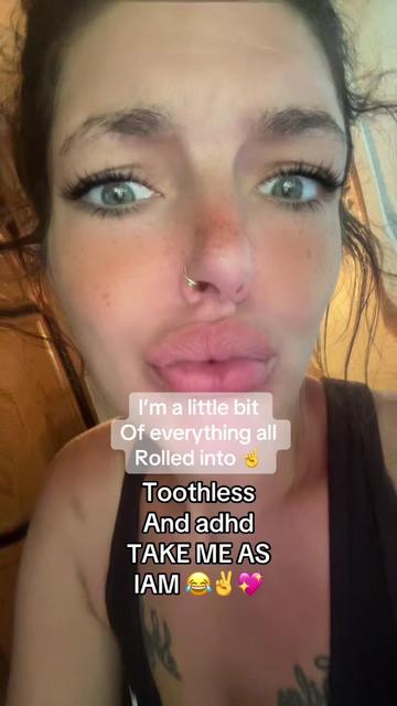 @🌻🌸TOOTHLESS AllyCaT🌸🌻